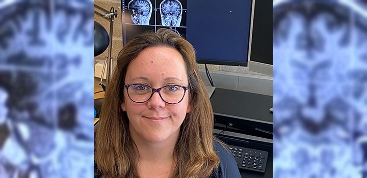 New research trial aims to address a disabling post-stroke condition