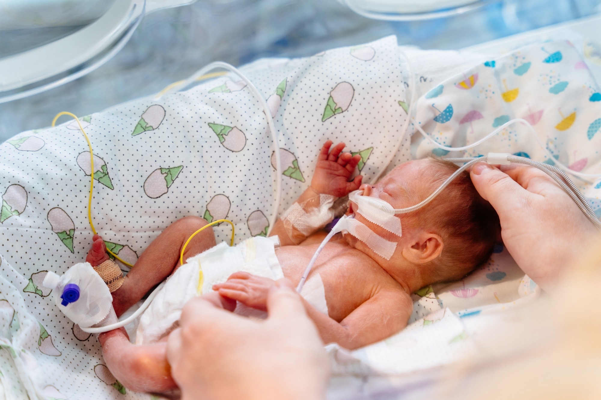 ​​​​​​​Study: Predictive gene expression signature diagnoses neonatal sepsis before clinical presentation. Image Credit: Iryna Inshyna/Shutterstock.com