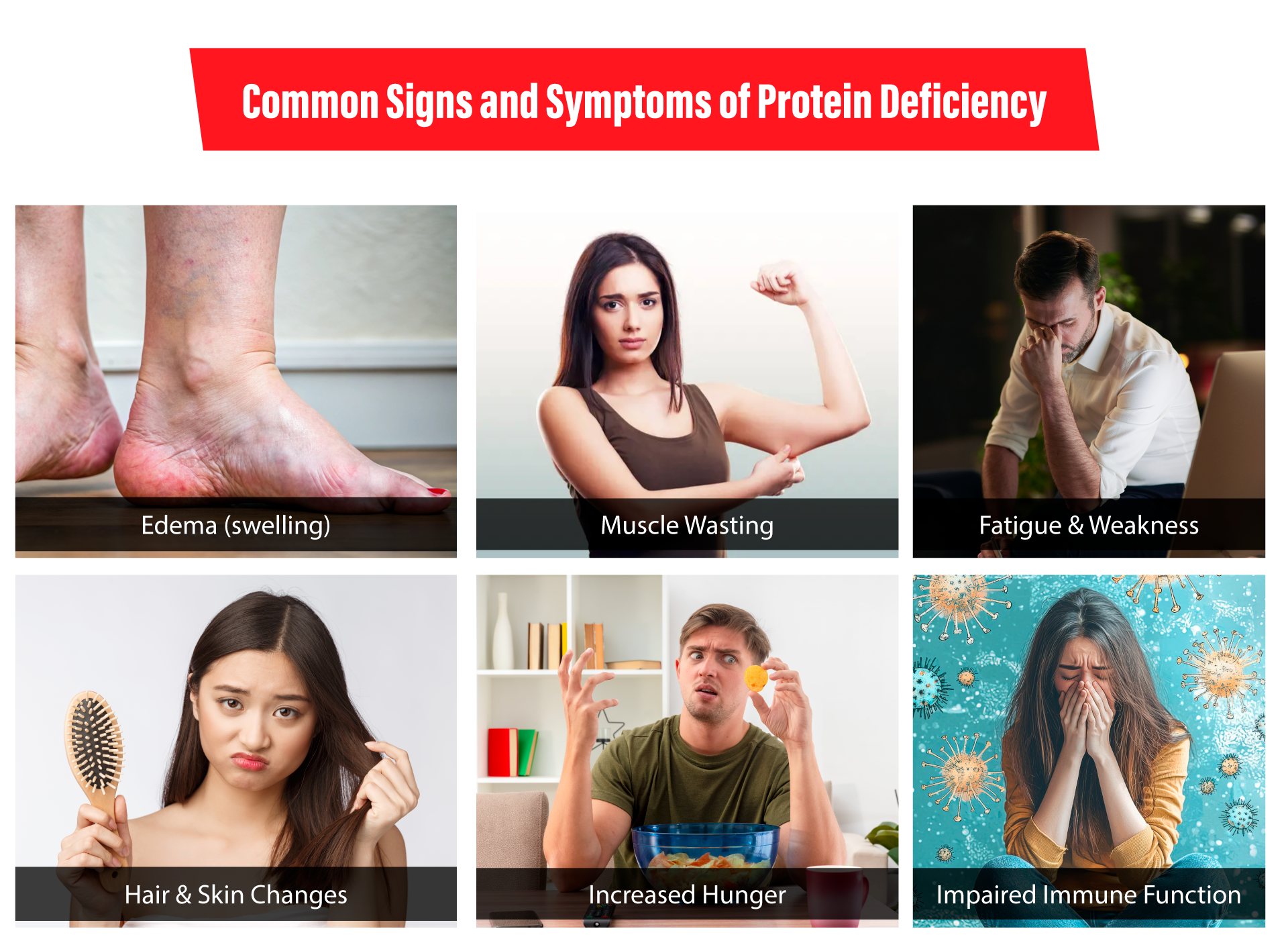 Signs and Symptoms of Protein Deficiency