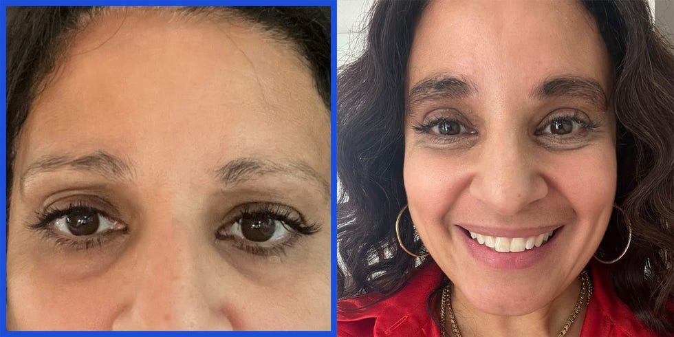 mona gohara, md, best eyebrow growth serum before and after photos