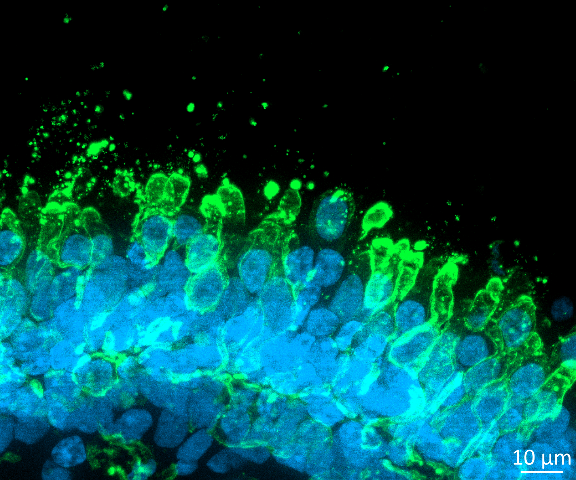 image of a retinal organoid