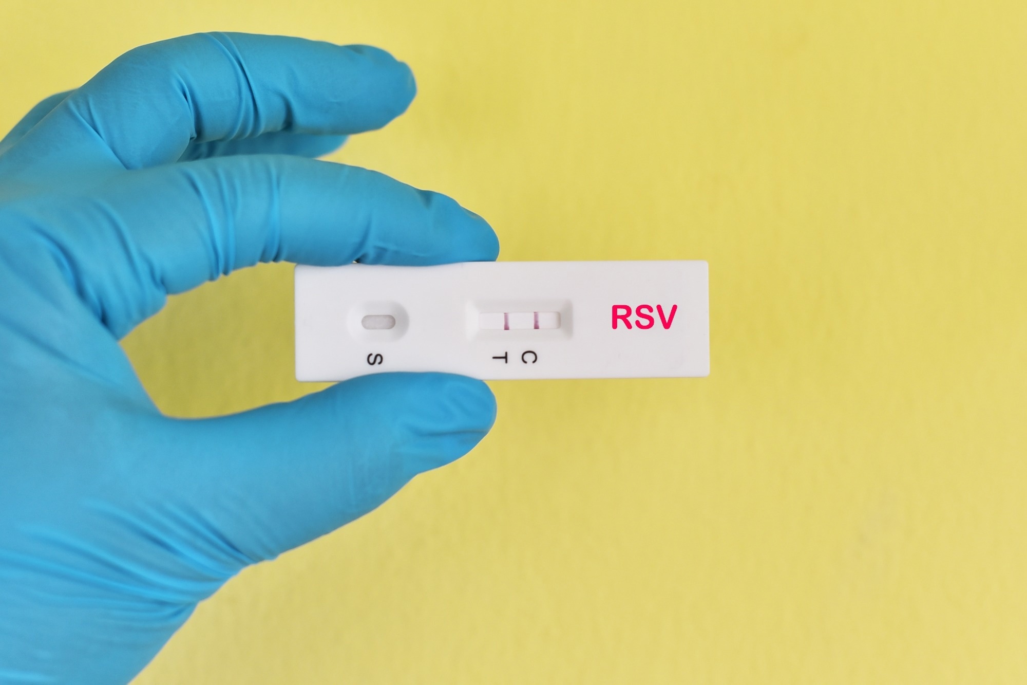 Study: Burden of Respiratory Syncytial Virus–Associated Hospitalizations in US Adults, October 2016 to September 2023. Image Credit: Jarun Ontakrai / Shutterstock