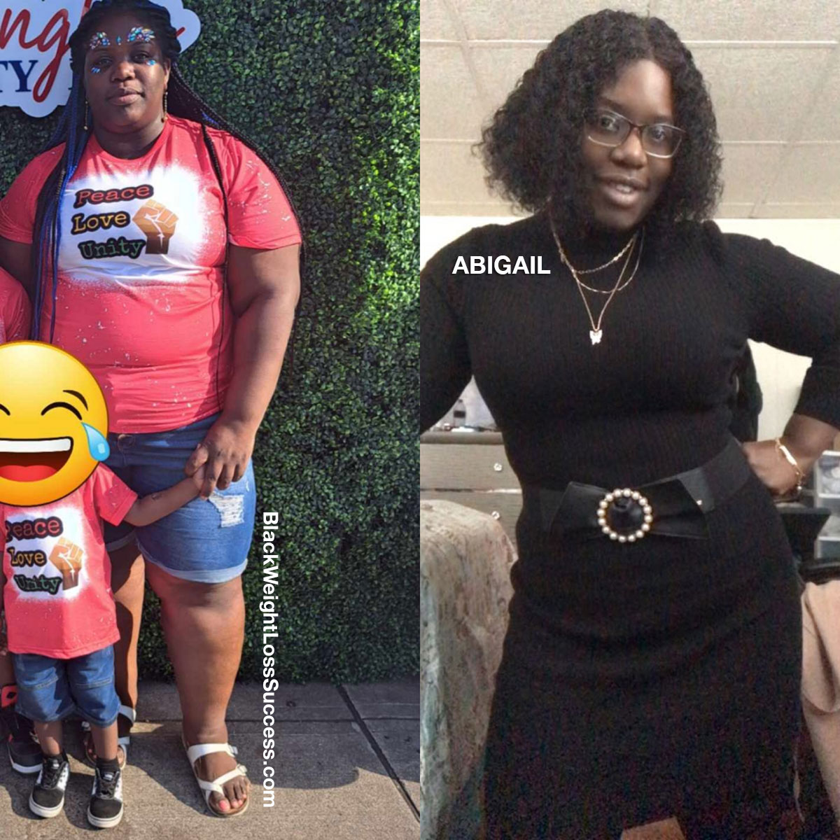 Abigail before and after weight loss