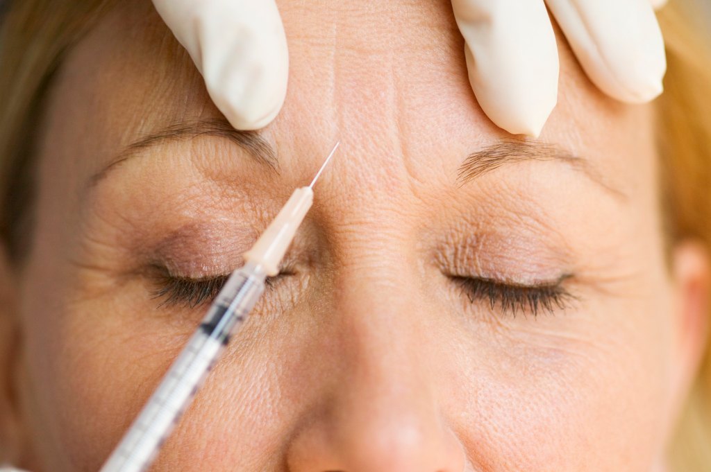 mature woman receiving injection treatment for wrinkles