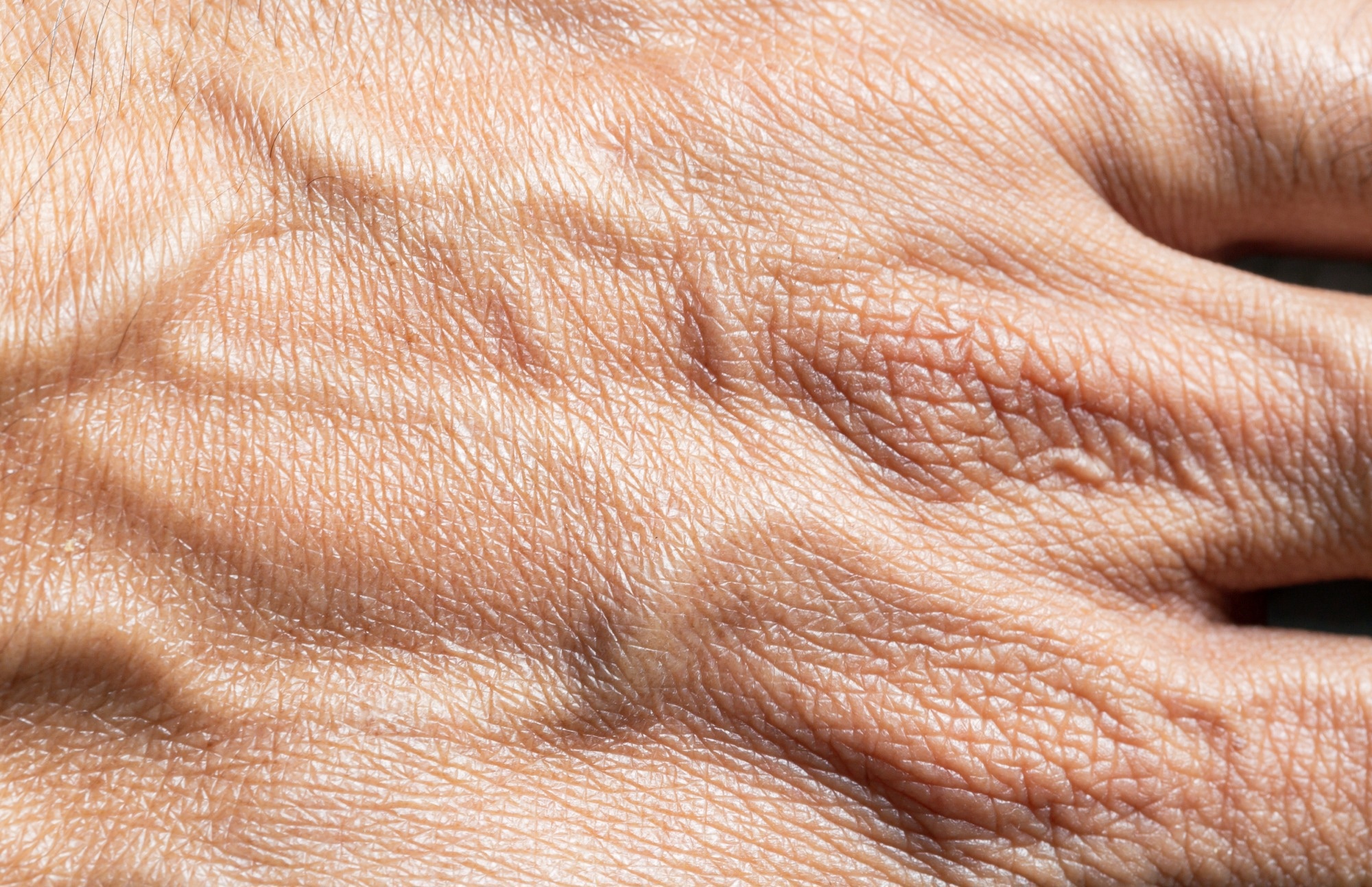 Research: Skin autonomous antibody production regulates host-microbiota interactions. Image Credit: banjongseal324SS / Shutterstock