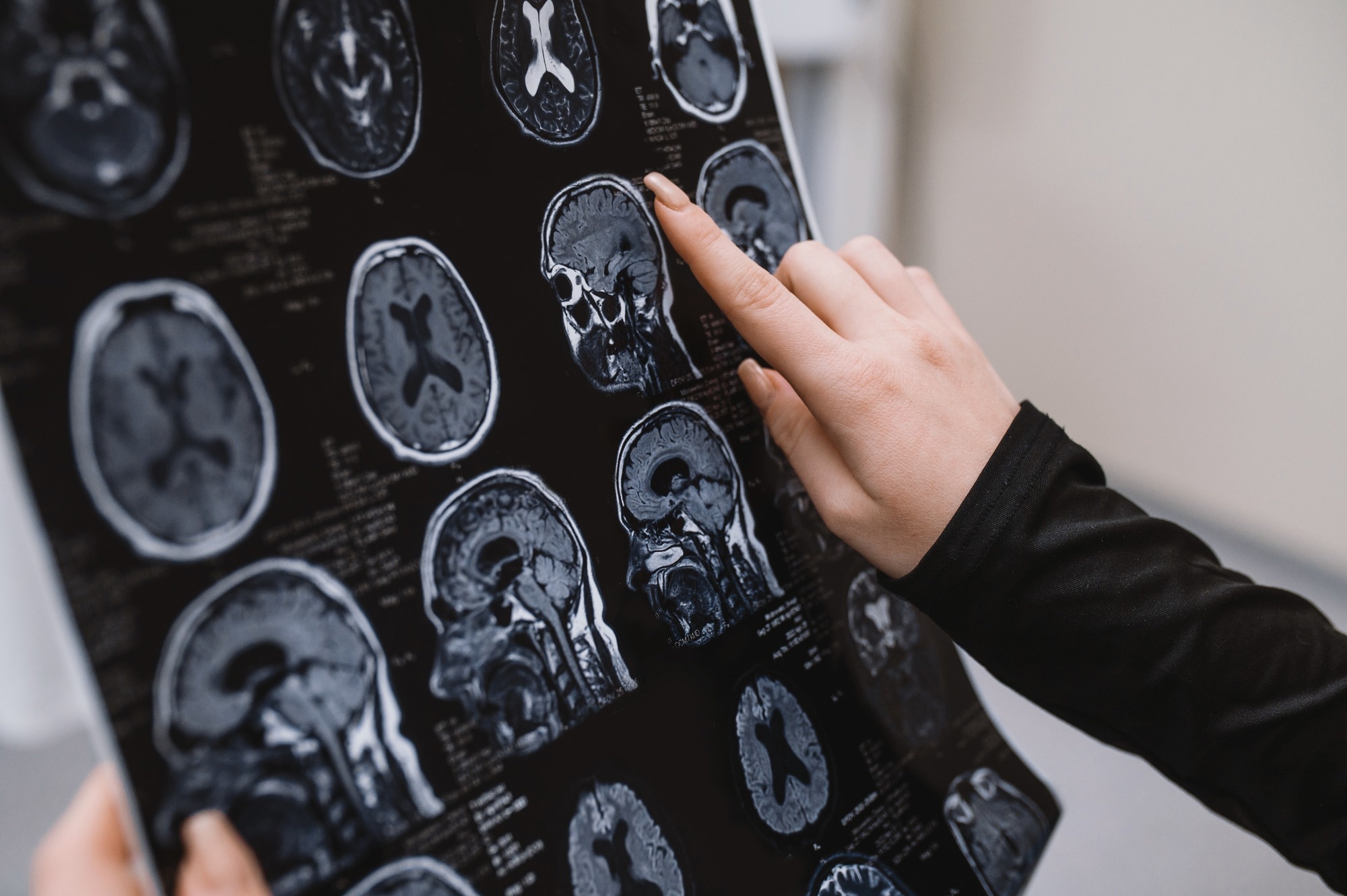 Study: Portable, low-field magnetic resonance imaging for evaluation of Alzheimer’s disease. Image Credit: illustrissima / Shutterstock