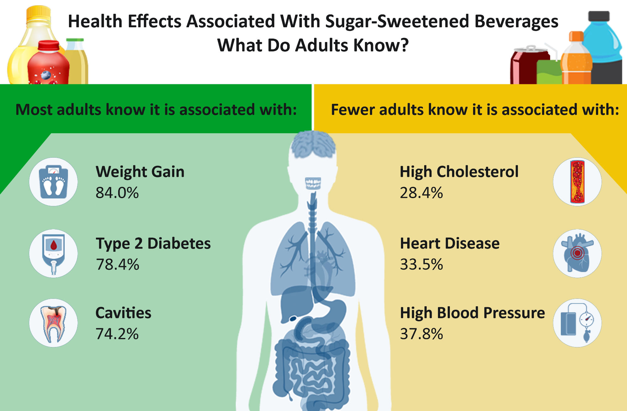 Study: Associations Between Knowledge of Health Conditions and Sugar-Sweetened Beverage Intake Among US Adults, 2021.