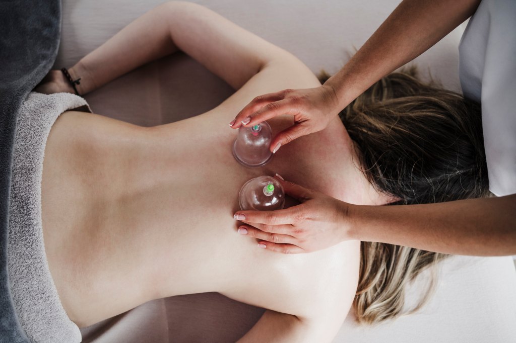 Female physical therapist doing vacuum cupping therapy on patient's back in clinic