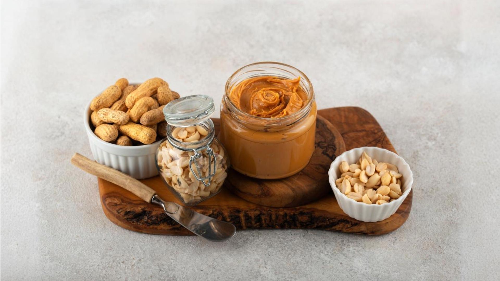 Nuts and Nut Butter