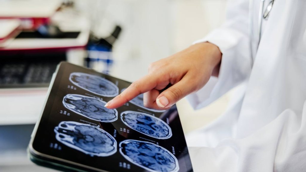 A female doctor looking at brain scans to check for MS